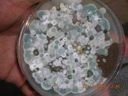 high-level-growth-of-micro-organism